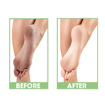 ProLinc Dry Heel Eliminator | Protect And Hydrate Dry Heels And Feet | Fast Absorbing And Non Greasy | Made In The USA | 4 Fl. Oz.