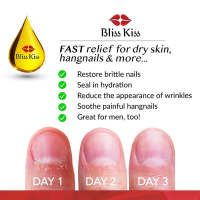 Bliss Kiss | Fragrance Free | Nail Oil Cuticle Dropper w/Vitamin E & Jojoba?Nail Strengthener Nail Growth Oil and Serum for Brittle Peeling Breaking Thin Nails | 0.5oz |
