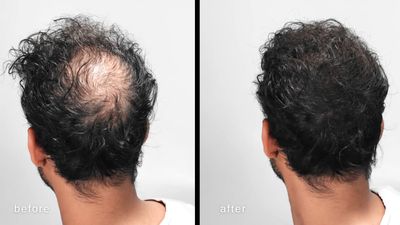 LUXE Hair Thickening Fibers - CONFIDENCE IN A JAR - 2 Months+ Supply! - Hypoallergenic, Dermatologist Tested - Multiple Colors Available (Dark Brown)