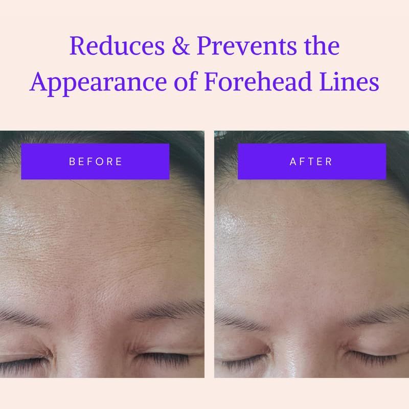 Blumbody Forehead Wrinkle Patches - Anti Wrinkle Facial Patches to Smooth Eyes &amp; Forehead Wrinkles - Non-Silicone Face Tape for Fine Wrinkles between Eyes &amp; Face - 50 Patches (Up to 60 day supply)