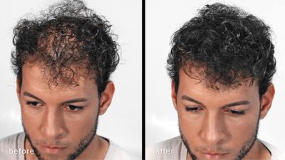 MAXX PRO-SERIES Volumizing Hair Fibers with real Keratin for Thinning Hair/Hair Loss - Dermatologist Tested and Certified Hypoallergenic - 60 days + supply - Multiple Colors Available (Dark Brown)