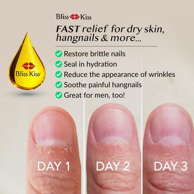 Bliss Kiss | Vanilla Fragrance | Nail Oil Cuticle Dropper w/Vitamin E &amp; Jojoba?Nail Strengthener Nail Growth Serum for Brittle Peeling Breaking Thin Nails | 0.5oz |