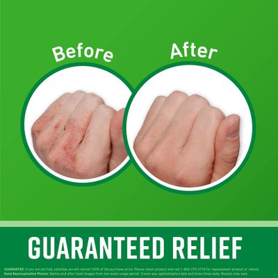 O'Keeffe's Working Hands Hand Cream; For Extremely Dry; Cracked Hands; 1 oz Tube; (Pack of 3)