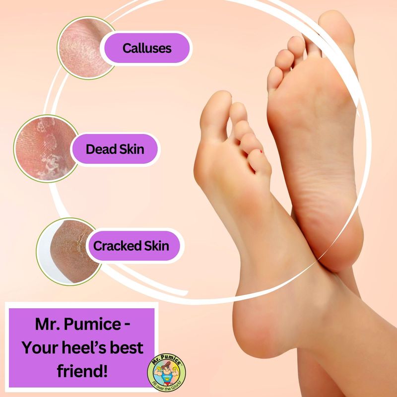 Mr. Pumice Callus Remover PUMI Bar: Pedicure Stone &amp; Foot/Heel Scrubber - Coarse Grit (4 Pack)