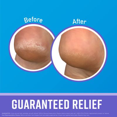 O'Keeffe's for Healthy Feet Night Treatment Foot Cream; Guaranteed Relief for Extremely Dry; Cracked Feet; Visible Results in 1 Night; 3.0 Ounce Tube; (Pack of 2)
