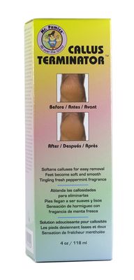 Mr. Pumice Callus Terminator 4oz