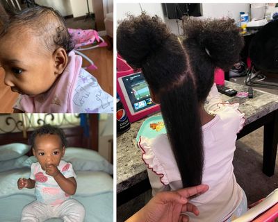 Natural Baby Kids Hair Care Products - Extra Strength Growing &amp; Nourishing Serum with Black Seed Oil for Powerful Thick, Full Hair Growth