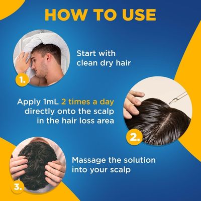 Minoxidil for Men 5% Extra Strength Hair Regrowth for Men fLsbok, 6 Month Supply by Kirkland Signature, 6 Pack (2 oz Bottle)