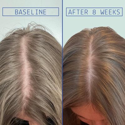 AAVRANI Hair Density Boosting Treatment - Ashwagandha, Vegan Collagen, And Turmeric Scalp Serum For Thicker, Fuller Hair - Vegan, Non-Greasy - 2 Fl Oz