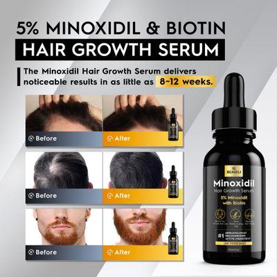 5% Minoxidil for Men Hair, Minoxidil for Women Hair Growth, Hair Growth Oil, Extra Strength Minoxidil Hair Loss Treatment Serum for Faster Stronger Thicker Hair Growth 1oz, 3 Bottles