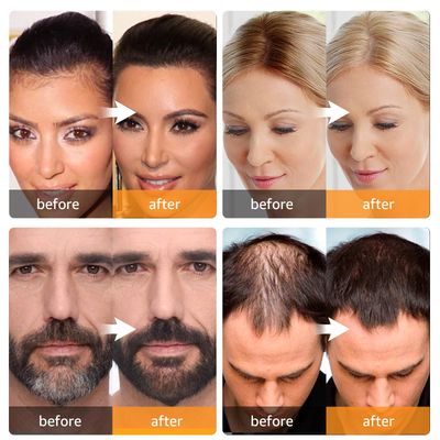 Abomet Root Touch Up Instantly Gray Hair Coverage Hairline Powder for Women &amp; Men, Medium Brown for Concealing Hair Loss &amp; Thinning Hair