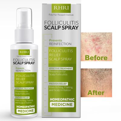 Folliculitis Scalp Spray | Dandruff Treatment for Dandruff, Psoriasis &amp; Folliculitis | Antifungal &amp; Anti Dandruff Itchy Scalp Treatment Formula Spray for Dry and Irritated Scalp