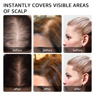 Instantly Hairline powder, Root touch up hair color for gray coverage, hair powder for women men bald spot loss and thin concealing?Dark Brown)