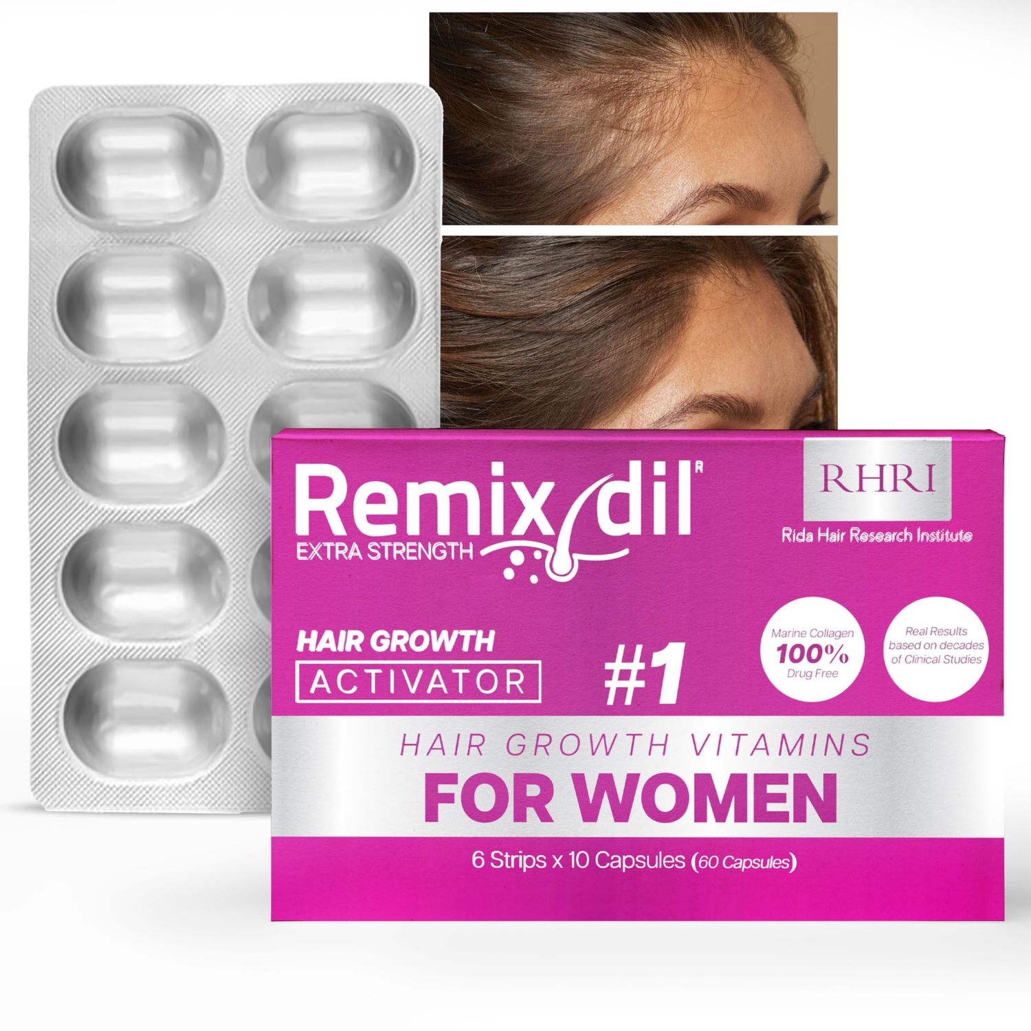Hair Growth Vitamins for Visibly Thicker &amp; Stronger Hair - Supplements for Hair Loss Treatment and Thinning Hair in Women