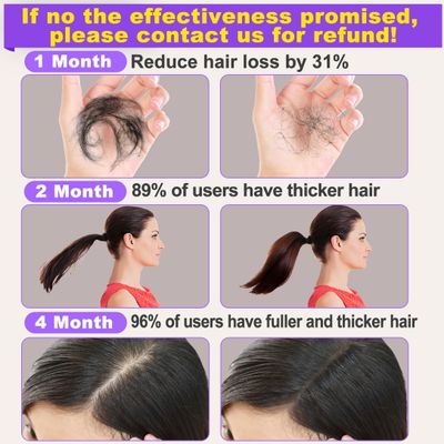 Rosemary Hair Growth Serum 2 Pack with Scalp Massager - Biotin, Argan Oil and Castor Oil for Thinning, Dry, Damaged Hair - Regrowth Treatment for Women