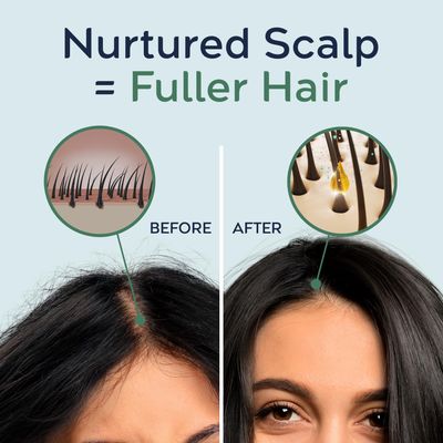 Tree To Tub Rosemary Water Spray for Hair Growth - Fermented Rice Water for Hair Growth Nature's Rosemary Hair Spray &amp; Nourishing Scalp Care