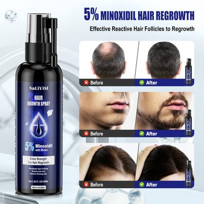 5 Minoxidil For Men And Women Hair Growth Spray - Hims Hair Regrowth Treatment For Stronger Thicker Longer Hair 2-3 Month Supply 100ml3.38oz