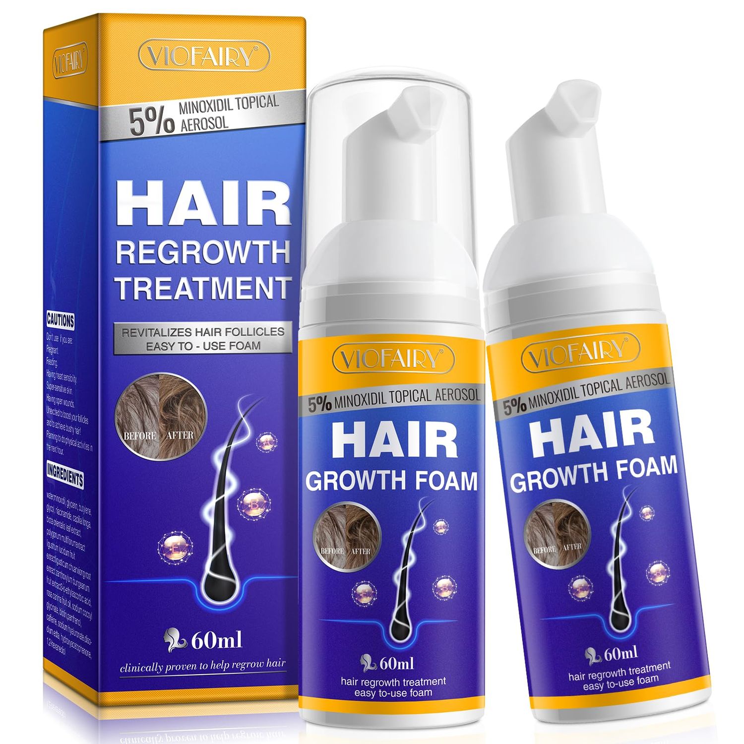 NATURE ZIRAN 5 Minoxidil Hair Growth Foam - Unscented, For Men Women, Helps Stop Hair Thinning Loss, Natural Growth Treatment, Biotin, 2 Ounce Pack of 2