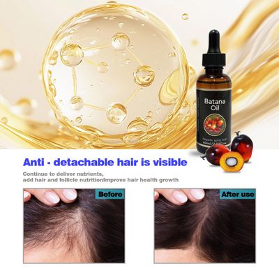 Batana Oil for Hair Growth, Organic Batana Oil Hair growth Strengthen All Hair Types for Men and Women 2.03 fl oz