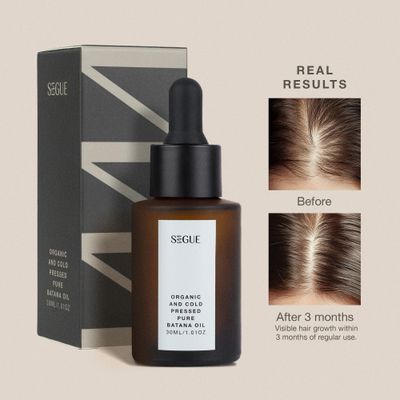 100 Raw Batana Oil for Hair Growth - Unrefined Batana Oil Pure Organic Extract - Cold Pressed Batana from Honduras - Batana oil Organic Scalp Treatment for Women Men with Weak, Dry Hair - 1oz