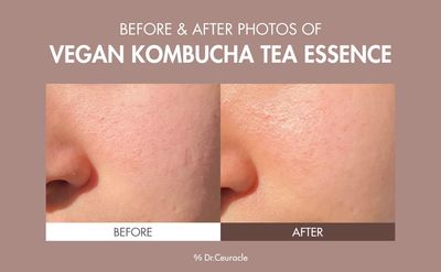 Dr.Ceuracle Vegan Kombucha Cream Essence Toner - Korean Skincare Hydrating Milky Toner with Kombucha Tea Extract, Centella Asiatica, Ceramide (150 ml 5.07 fl. oz.)