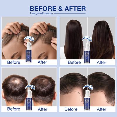 VENANOCI Hair Growth Serum Spray with Rosemary, Biotin, Batana Oil Rice Water - Natural Anti-Hair Loss Treatment for Thinning Hair - Promotes Thicker, Fuller Hair for Women Men - All Hair Types