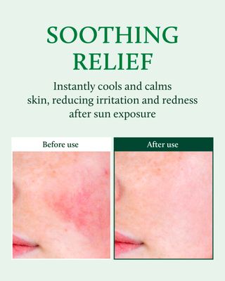 YADAH Cactus Soothing Gel (16.9fl oz) - Sunburn Relief, Calm, Cool & Soothe Irritated Skin, Face Redness. Korean Skin Care. 95% Cactus Extract, Vegan.