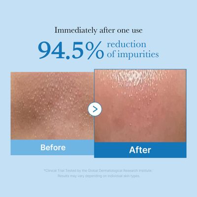medicube Zero Pore Blackhead Deep Cleansing Oil Makeup Remover for all skin types, Daily Moisture Facial Cleanser, Low-Irritation Korean Skin Care (205ml / 6.93 fl.oz)