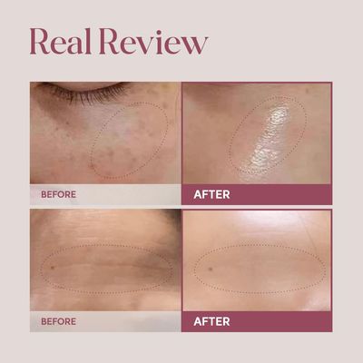 LULUBEU Reborn Cream with NK Cell Technology, Firming &amp; Hydrating Facial Cream, 1.69 fl oz