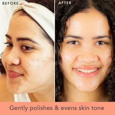 Face Scrub and Face Wash, Gentle Exfoliating, Cleansing Facial Scrub Exfoliator, Natural &amp; Organic Ingredients