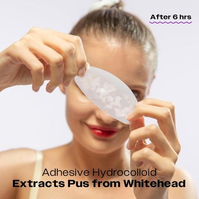 Avarelle ZitOut Nose Patches (16 Strips) Tea Tree Acne Patches for Nose Zits & Pore Blackhead Nose Strips for Blackheads with Niacinamide Blackhead Strips Hydrocolloid Nose Patches