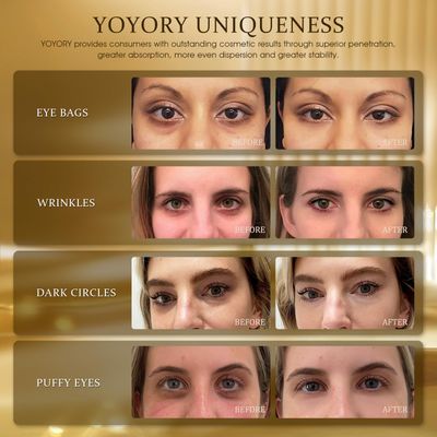 YOYORY Under Eye Patches Masks - Collagen & Hyaluronic Acid for Removing Eye bags, Puffiness, Dark Circles Smoothing Skin Care Treatment for Women and Men, (60 Pcs) Gold