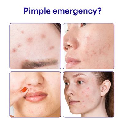 MEDIHEAL Derma Clear Madecassoside Blemish Patch (44 Counts) - Acne Spot Protection, Fast Healing with Madecassoside &amp; Niacinamide
