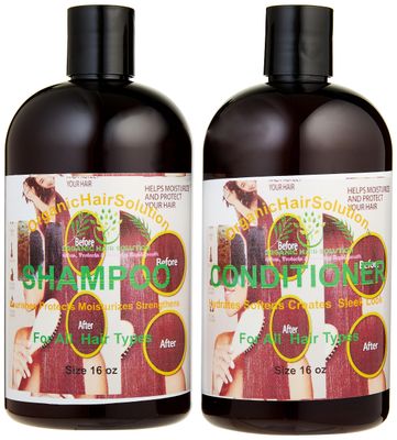 Organic Hair Solution- Conditioner Shampoo Set -with 100 Pure Aloe vera Tea Tree-for Itchy and Dry Scalp, SulfateParaben Free -Promotes Hair Growth, Fights Hair Loss Dandruff for Men Women