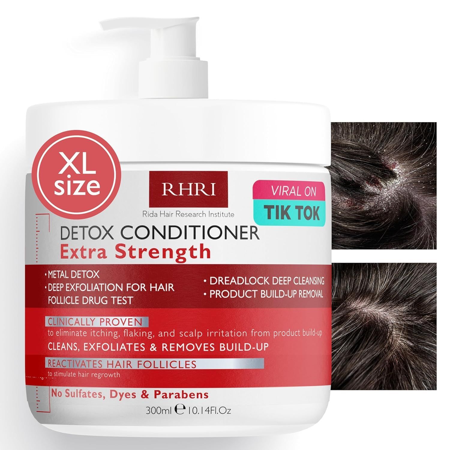 Detox Conditioner for Men and Women Extra Strength and Deep Cleansing for Scalp Hair Metal Detox, Build-Up Removal Hair Follicle Care No Sulfates, Dyes or Parabens 300ml
