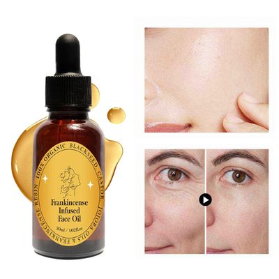 Frankincense Resin Oil for Face, Frankincense Oil for Skin, Frankincense Resin Infused Organic Black Seed, Castor Jojoba Oil for Face, Facial Moisturizing Anti-Aging Serum (1PC, 1)