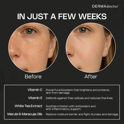 DERMAdoctor 20 Vitamin C Face Oil with Vitamin E Ferulic Acid Kakadu C High-Potency Evening Oil, Anti-Aging, Brightening Hydrating Glow For All Skin Types - 1.01 fl oz