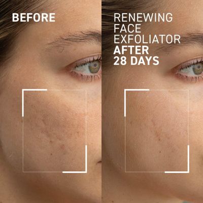 Dr. Brandt Microdermabrasion Renewing Face Exfoliator - Reduces Dull Skin, Uneven Texture, Fine Lines, Acne Scars Wrinkles - 2.0 oz