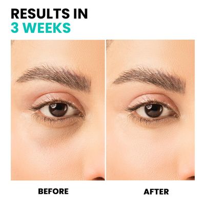 Triple Correction Eye Serum- with Anti-Aging Ingredients, Targets Under-Eye Dark Circles, Puffiness and Promotes Healthy Skin for a Visibly Revitalized Appearance, 10ml