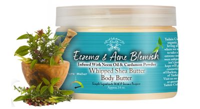 Yadain Eczema Acne Blemish Body Butter Whipped Shea Butter for Face and Body Moisturizing Natural Body Butter for Skin Hydration Oil Control, 12oz