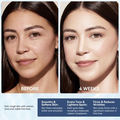 Instant Face Lift Cream with Retinol, Collagen Hyaluronic Acid, Neck Cream for Tightening and Firming - Anti Aging Face Moisturizer for Women Men Reduce Wrinkle, Retinol Cream for Face, 1.7 FL OZ