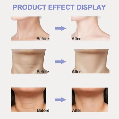 lymznus Neck Firming Cream, Neck Tightening Cream, Tighten and Lift Firming Neck Cream, Neck Creams for Tightening and Firming Sagging Skin, Help Reduce Fine Lines Wrinkles