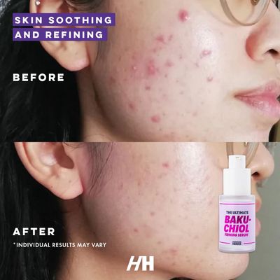 Handmade Heroes The Ultimate Bakuchiol Firming Face and Neck Lightweight Cream, Anti-Aging for Neck and D collet , Day Night Face Cream - Moisturizing and Lifting