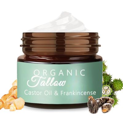 Vbolre Grass Fed Beef Tallow with Frankincense Oil and Castor Oil, Organic Grass Fed Beef Tallow for Skin, Whipped Beef Tallow Frankincense Oil Castor Oil for Skin Face Body Moisturizer (1)