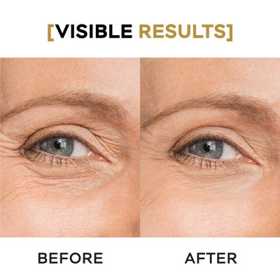 VITASEI Moisturizing Eye Cream wAloe Vera, Collagen, Hyaluronic Acid, Cotton Stem Cells for Dark Circles, Puffiness Bags - Under Eye Hydration Cream for Women Men (1 Fl Oz)