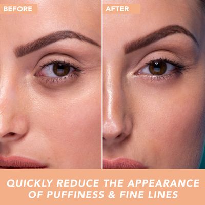 Hyaluronic Acid Eye Cream - USA Made with Natural Organic Ingredients, Cooling Under Eye Gel Brightener, Dark Circles Treatment with Hyaluronic Acid Glycerin, Reduces Puffiness Bags Under Eyes