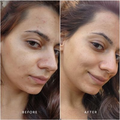 True Botanicals Anti-Aging Essentials Increase Hydration, Treat Fine Lines Wrinkles Contains Chebula Active Serum, Renew Pure Radiance Oil, and Phyto Retinol Advanced Clinical Cream
