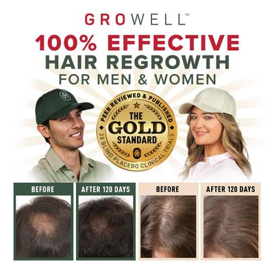 GroWell Hair Growth Laser Cap - Red Light Therapy Hair Growth - Laser Cap Hair Regrowth For Women and Men - Laser Hair Growth Cap - LED Hair Growth Hat - 650 nm Red Light Therapy for Hair Loss -Black