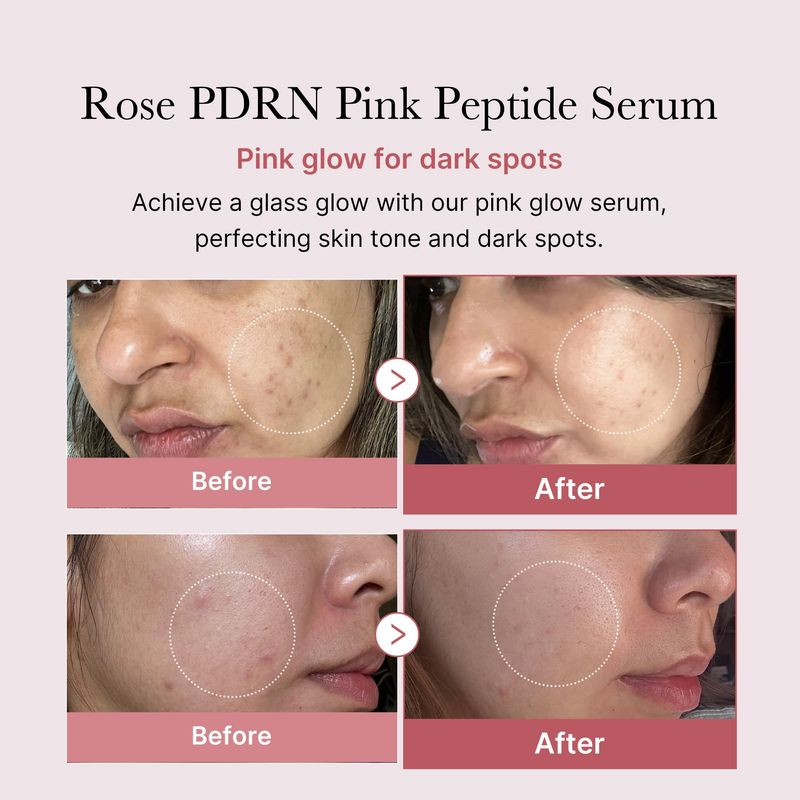 medicube PDRN Pink Peptide Serum, Pink glow serum, Peptide, Niacinamide, Hydrating Moisturizing Firming, Uneven Skin Tone, Korean Skincare 1.01 fl.oz. (1.01 fl.oz., Rose PDRN (Vegan))