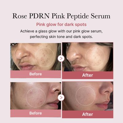 medicube PDRN Pink Peptide Serum, Pink glow serum, Peptide, Niacinamide, Hydrating Moisturizing Firming, Uneven Skin Tone, Korean Skincare 1.01 fl.oz. (1.01 fl.oz., Rose PDRN (Vegan))
